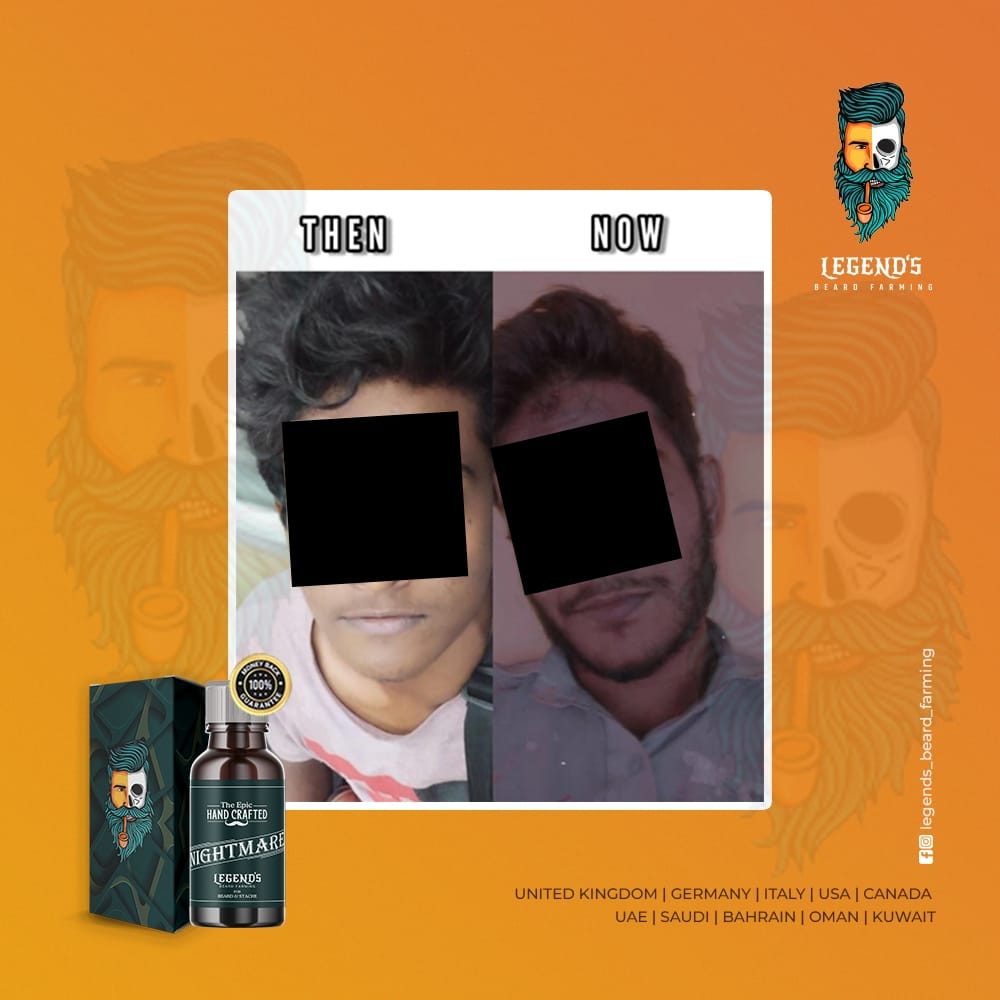35ml BEARD SERUM + DERMA ROLLER (0.5mm) COMBO