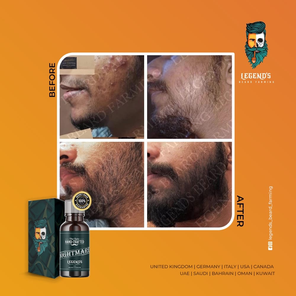 35ml BEARD SERUM + DERMA ROLLER (0.5mm) COMBO