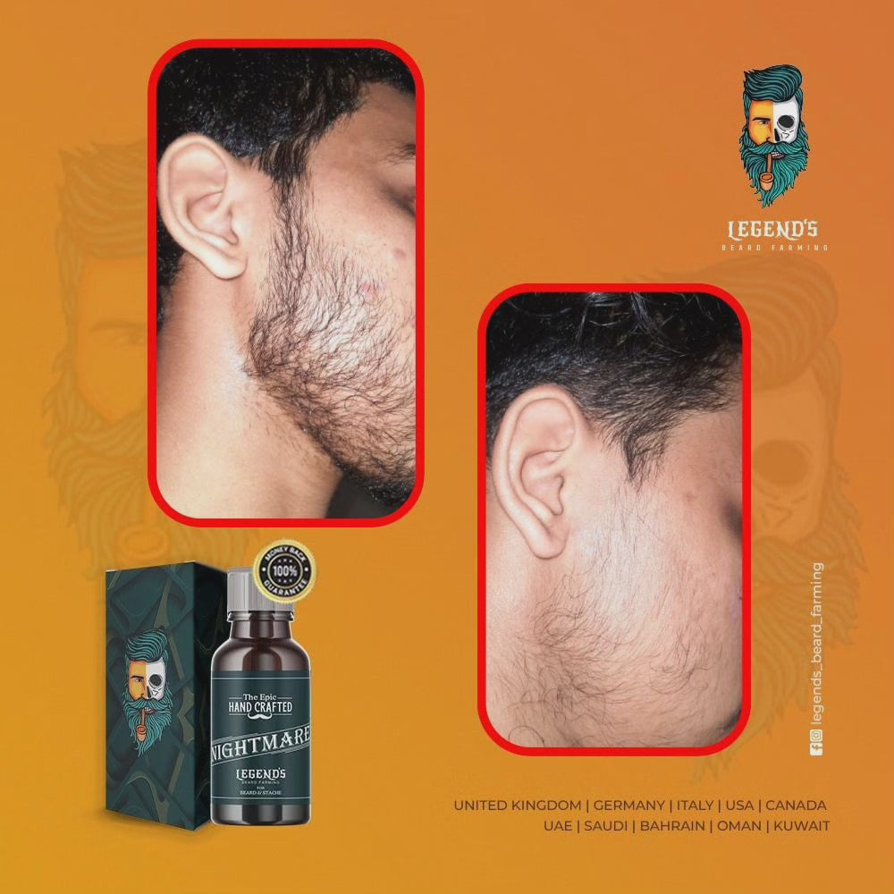 60ml BEARD SERUM  + DERMA ROLLER (0.5mm) COMBO