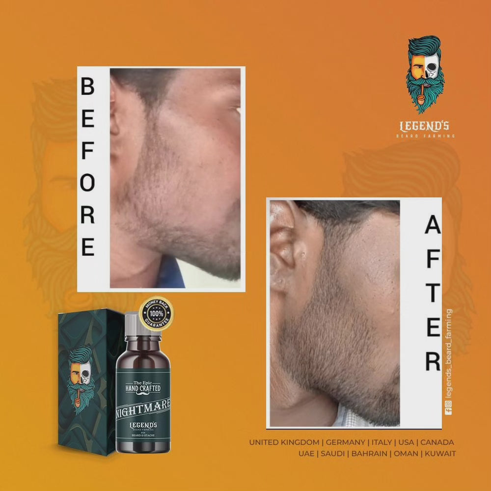 60ml BEARD SERUM  + DERMA ROLLER (0.5mm) COMBO