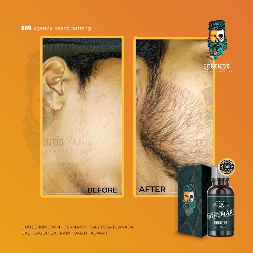 35ml BEARD SERUM + DERMA ROLLER  (0.5mm) COMBO